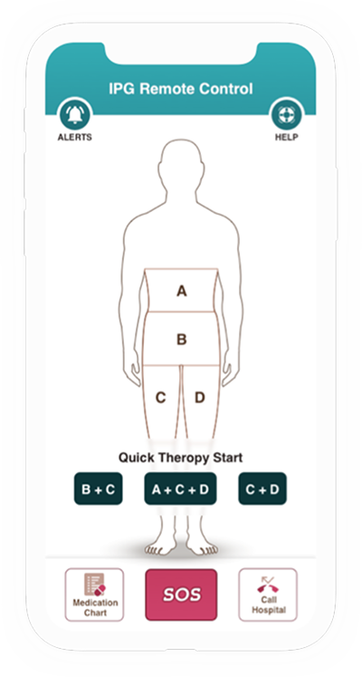 Original remote control mockup — screen 1